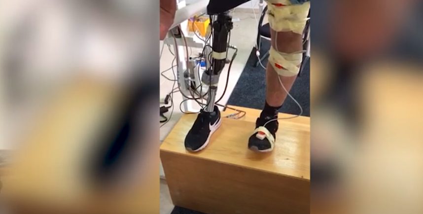 Bh. naučnici izumili pametnu protezu koja oponaša normalan hod, Life.ba