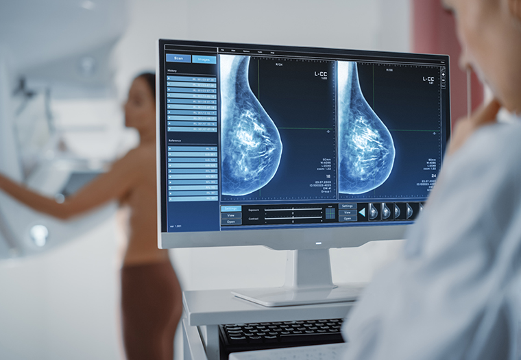 Žene bi na mamografiju trebale i prije 50. godine, Life.ba